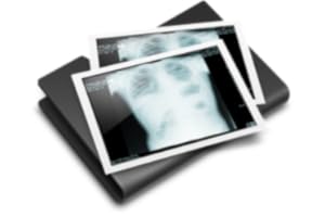 Dicom Viewer